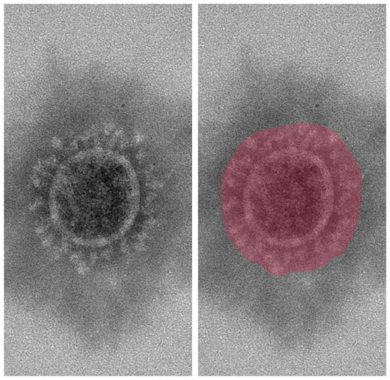 “Segmentation of a Corona Virus”. P. Klimczok, A. Omar, M. Laue and N. Körber, "EMViR - Electron Microscopy Image Dataset Of Labelled Respiratory Viruses For Deep Learning Model Development," 2025 IEEE 22nd International Symposium on Biomedical Imaging (ISBI), Houston, TX, USA, 2025, pp. 1-5, doi: 10.1109/ISBI60581.2025.10980686.